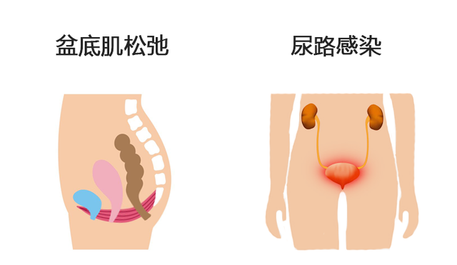 夜尿多不是小事！需警惕4种疾病