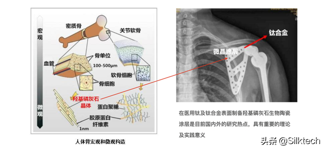 丝素蛋白｜再生修复医学-仿生骨