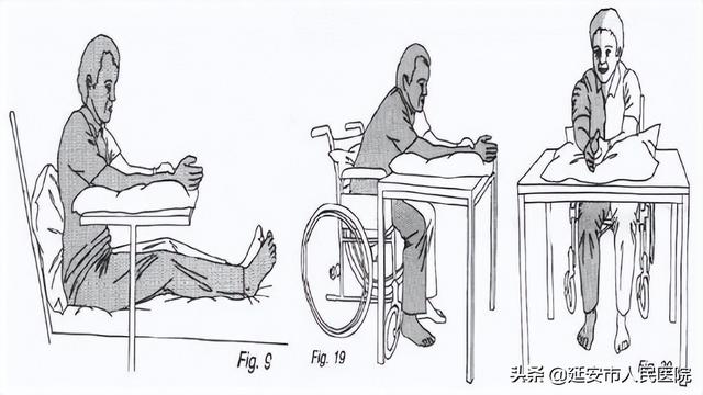 当肩手综合征(RSD)来临，及早干预有方法