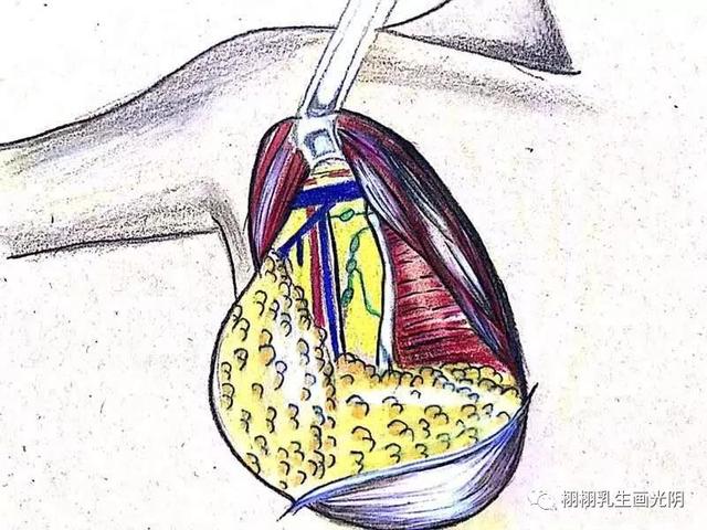 走进最贵的房子-图解乳房结构